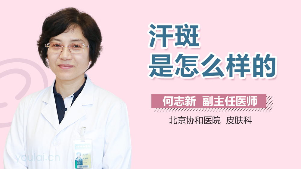 汗斑是怎么样的