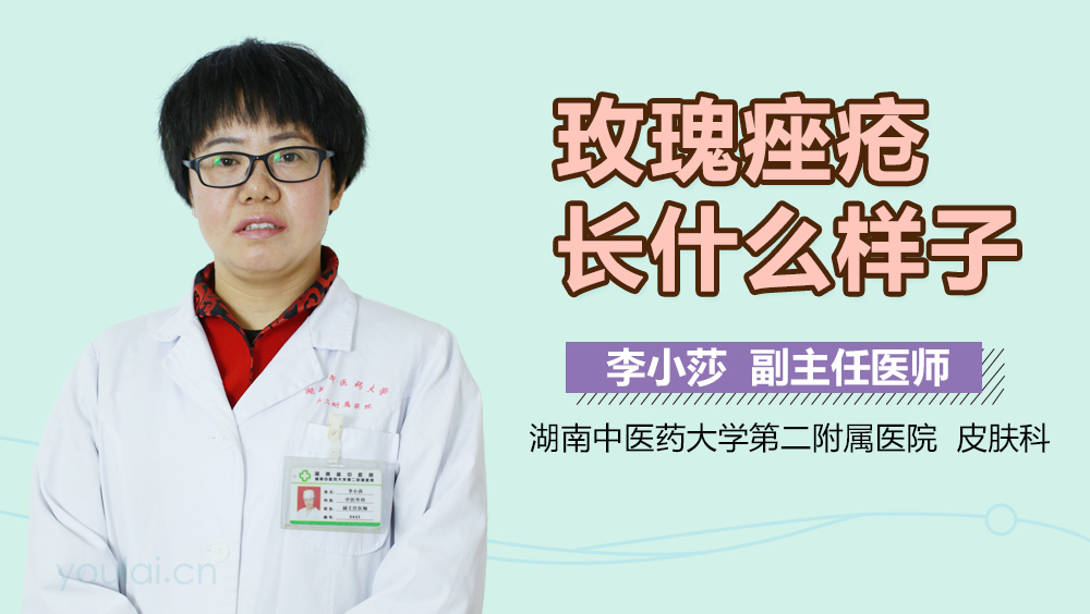 玫瑰痤疮长什么样子