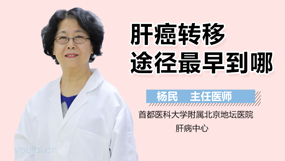 肝癌转移途径最早到哪