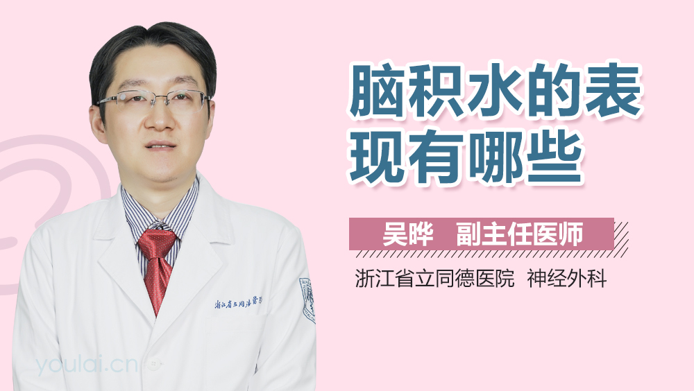 脑积水的表现有哪些