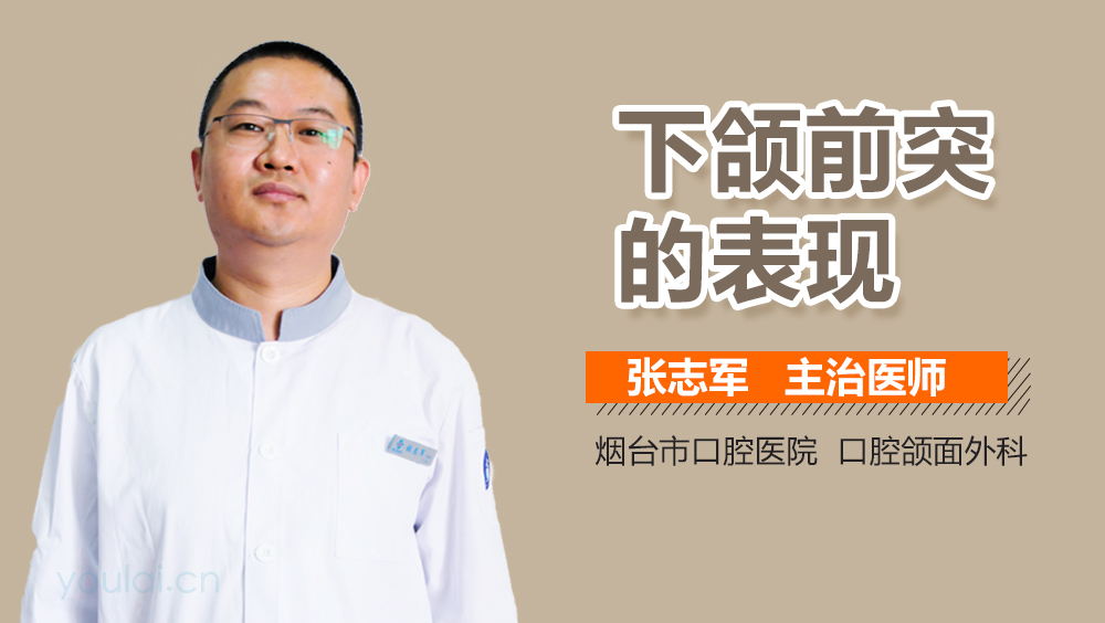 下颌前突的表现