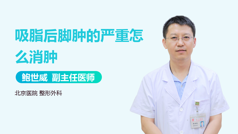 吸脂后脚肿的严重怎么消肿