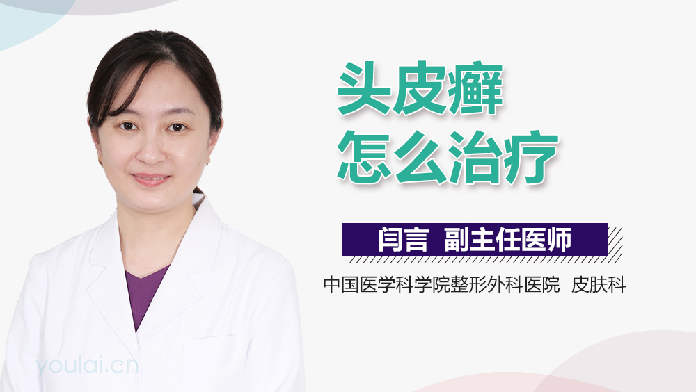 头皮癣怎么治疗