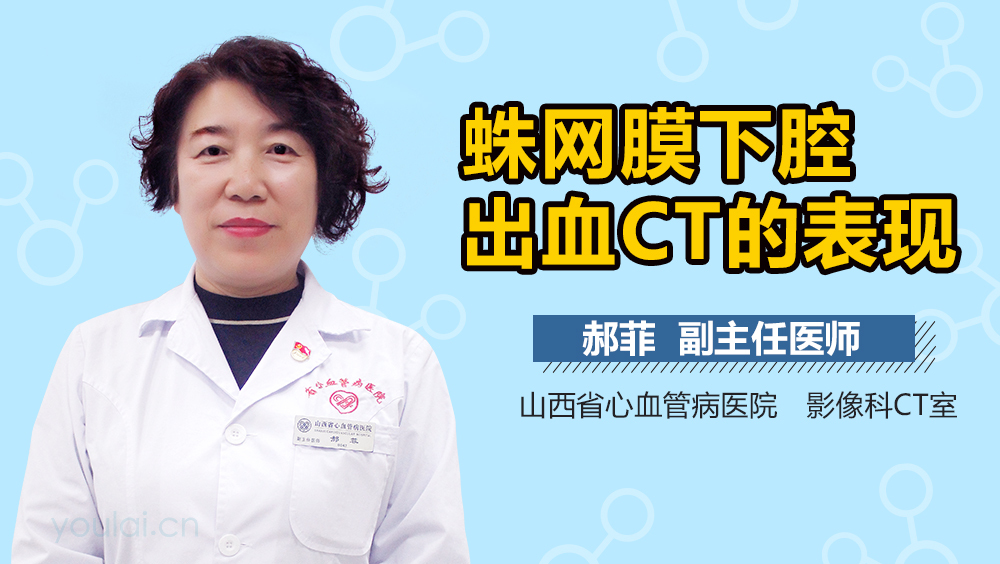 蛛网膜下腔出血CT的表现