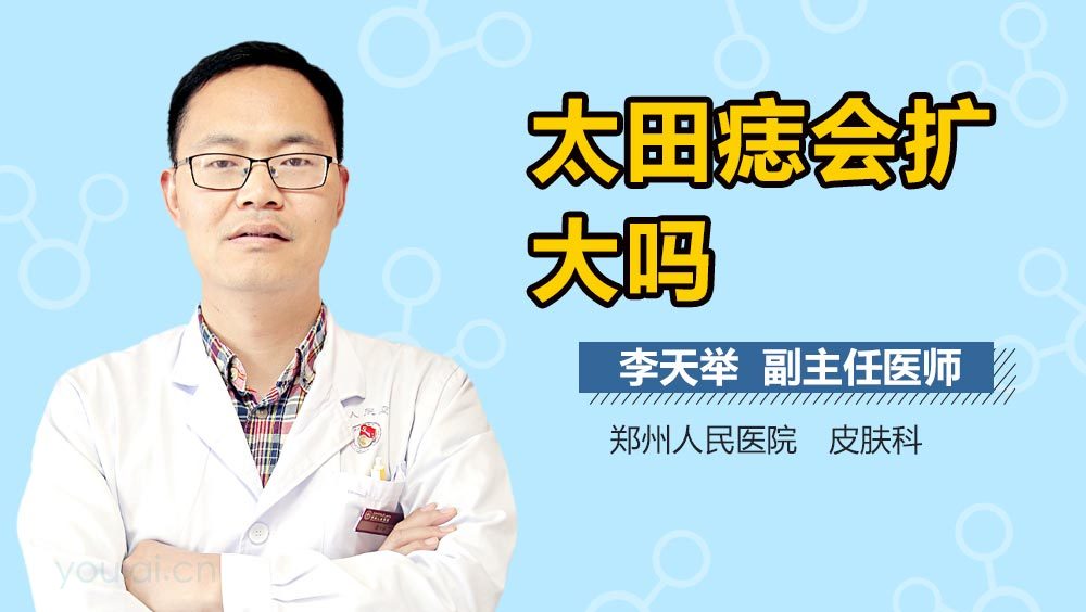 太田痣会扩大吗