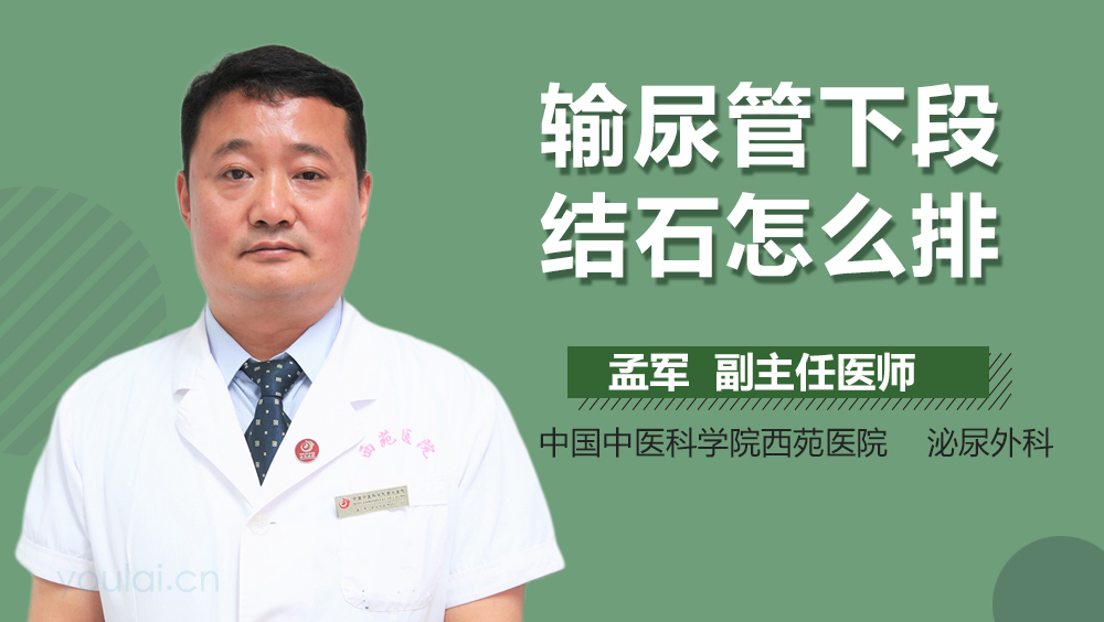 输尿管下段结石怎么排