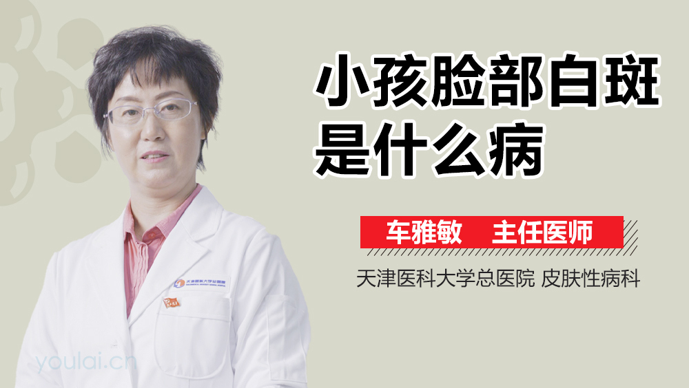 小孩脸部白斑是什么病