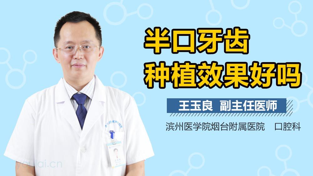 半口牙齿种植效果好吗
