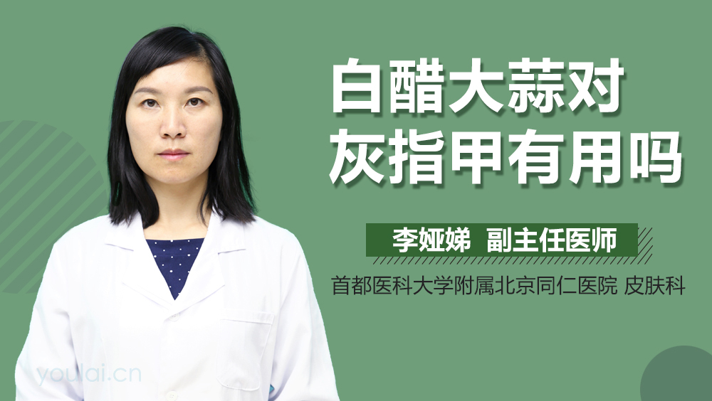 白醋大蒜对灰指甲有用吗