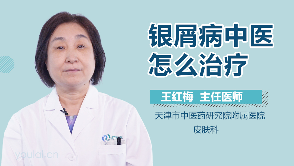 银屑病中医怎么治疗