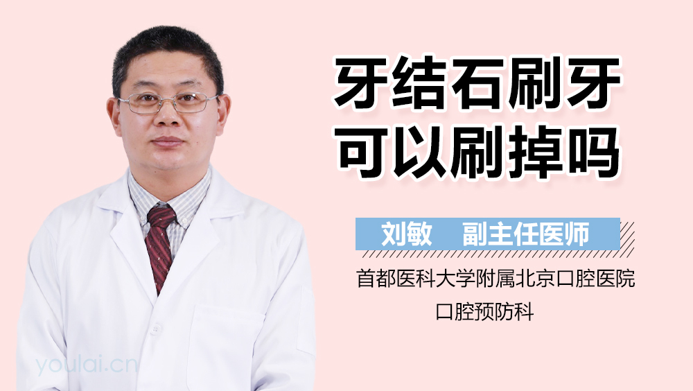 牙结石刷牙可以刷掉吗