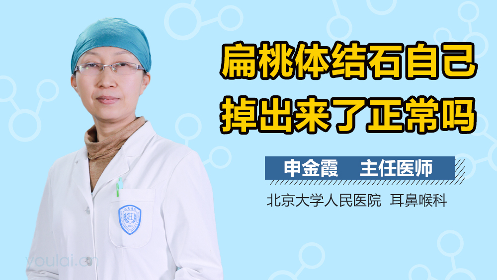 扁桃体结石自己掉出来了正常吗