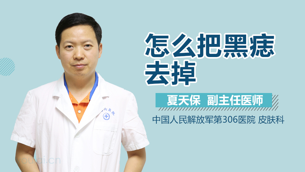 怎么把黑痣去掉