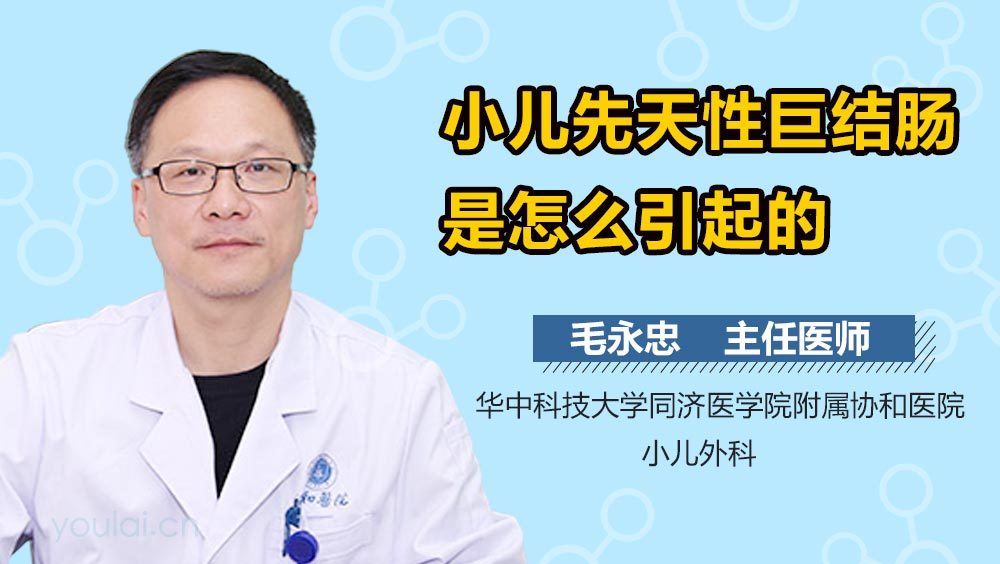 小儿先天性巨结肠是怎么引起的