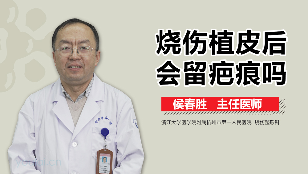 烧伤植皮后会留疤痕吗