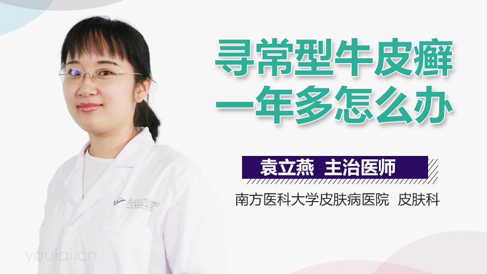 寻常型牛皮癣一年多怎么办