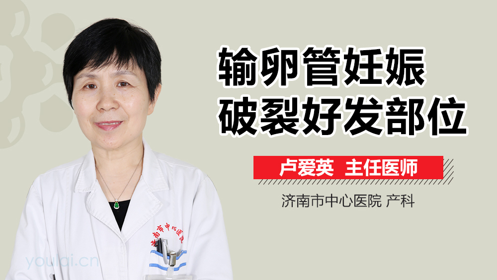 输卵管妊娠破裂好发部位