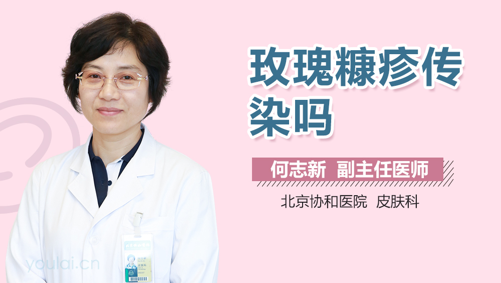 玫瑰糠疹传染吗