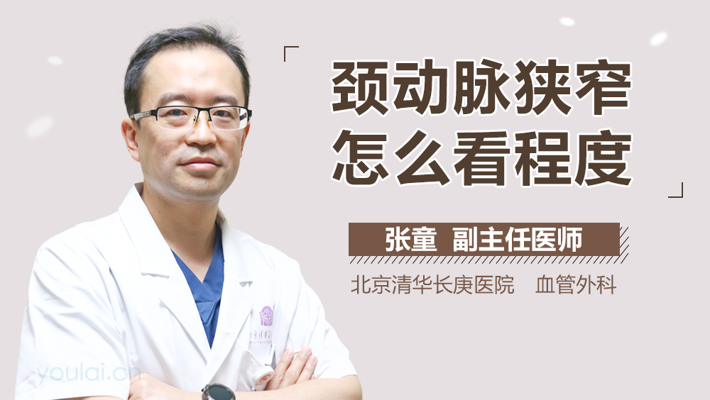 颈动脉狭窄怎么看程度