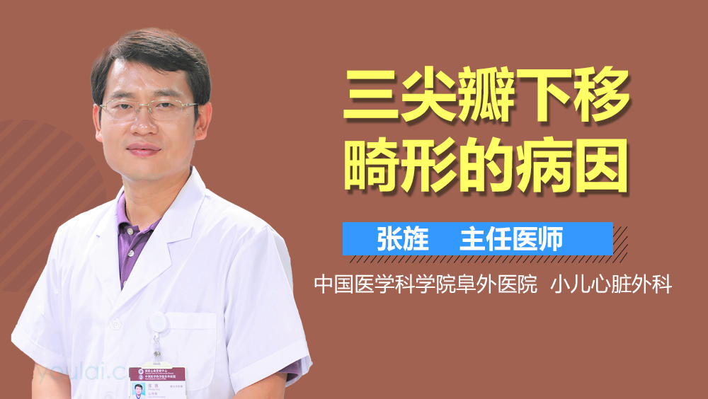 三尖瓣下移畸形的病因