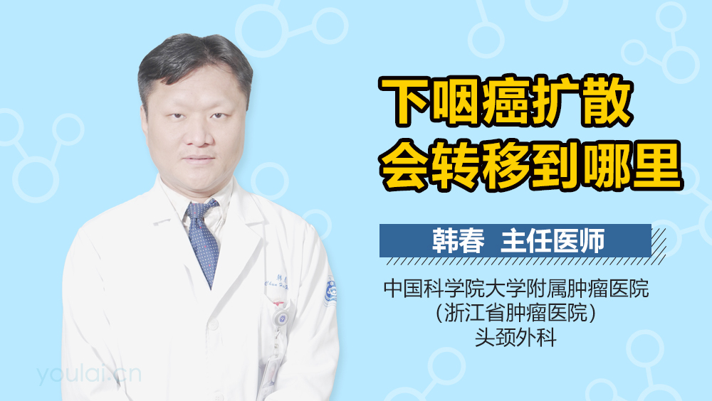 下咽癌扩散会转移到哪里