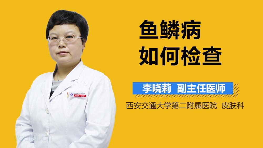 鱼鳞病如何检查