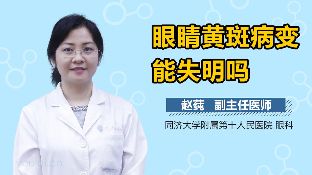眼睛黄斑病变能失明吗
