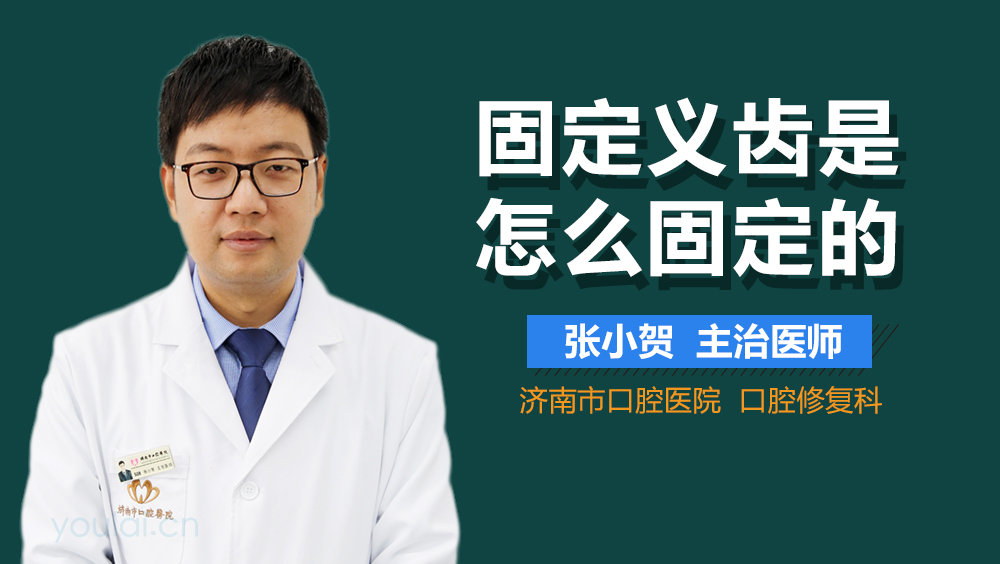 固定义齿是怎么固定的