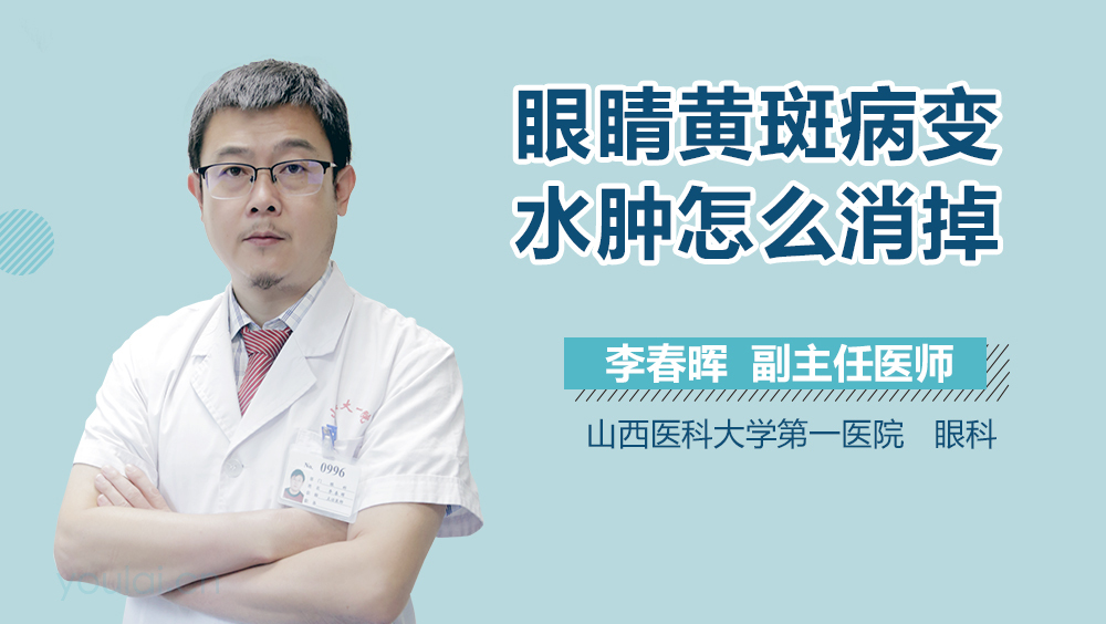 眼睛黄斑病变水肿怎么消掉