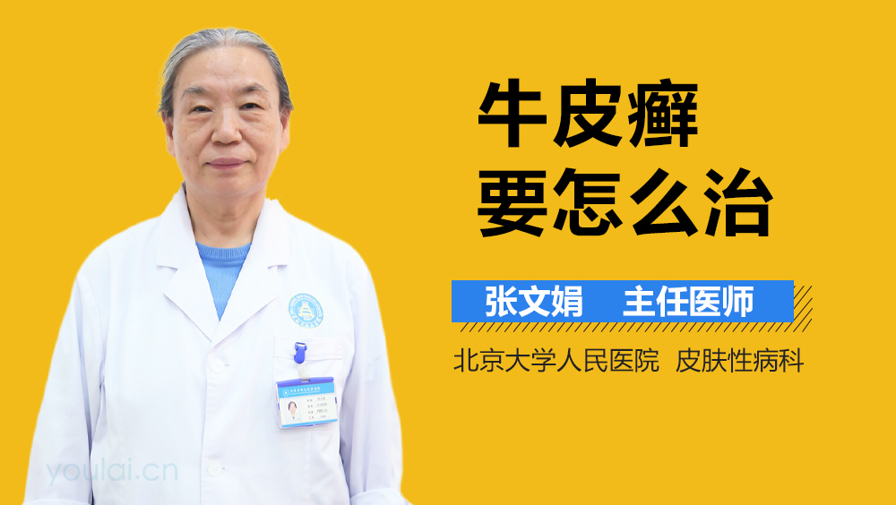 牛皮癣要怎么治