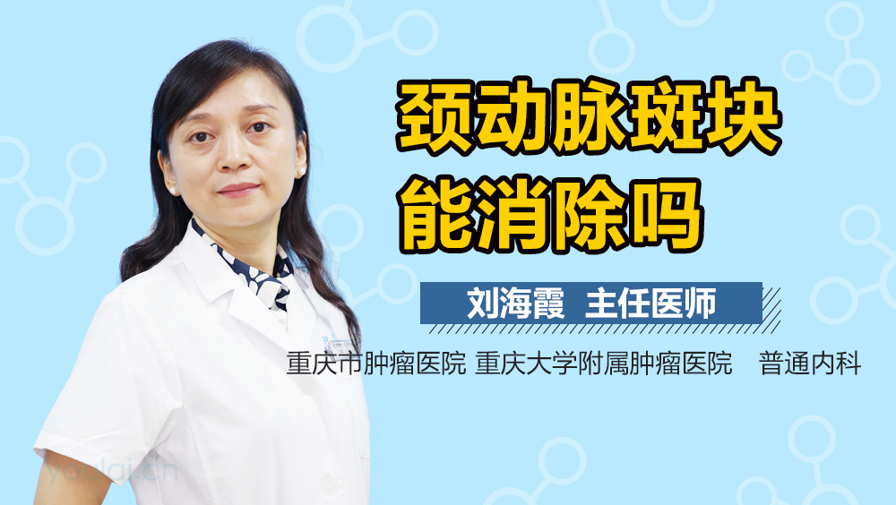 颈动脉斑块能消除吗