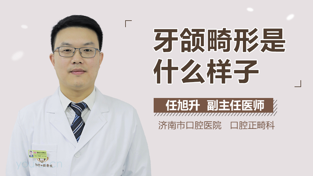牙颌畸形是什么样子