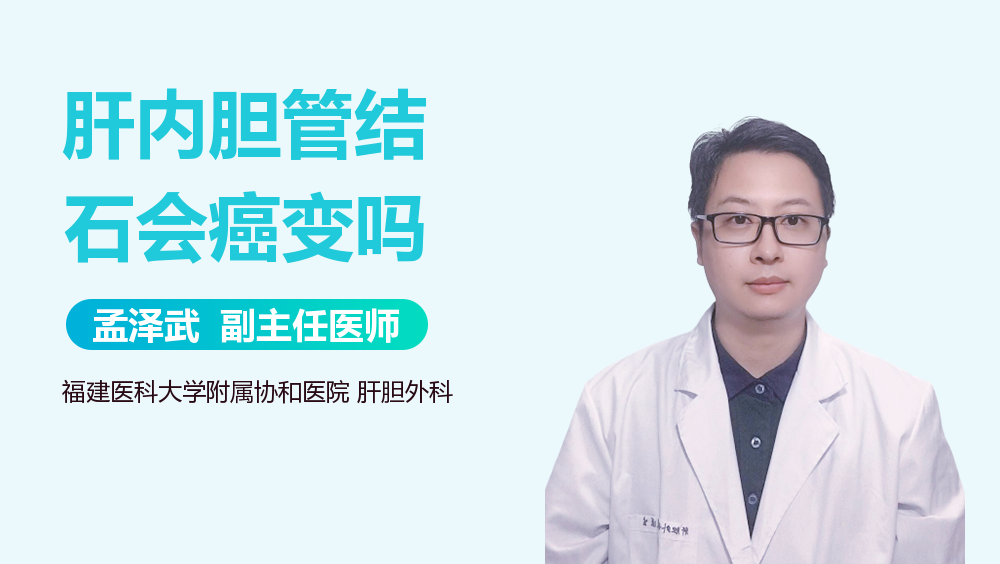 肝内胆管结石会癌变吗