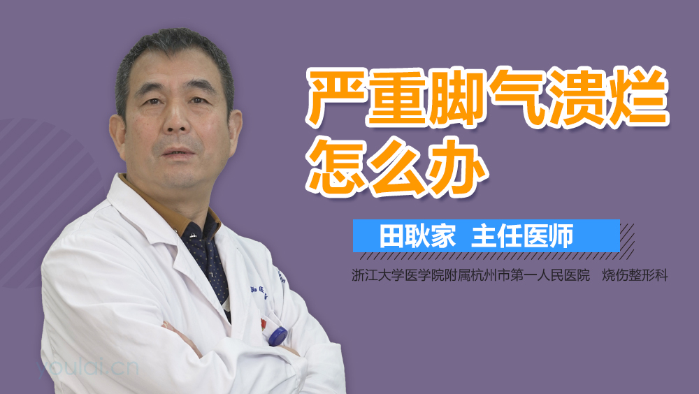 严重脚气溃烂怎么办