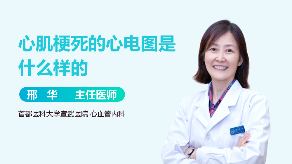心肌梗死的心电图是什么样的