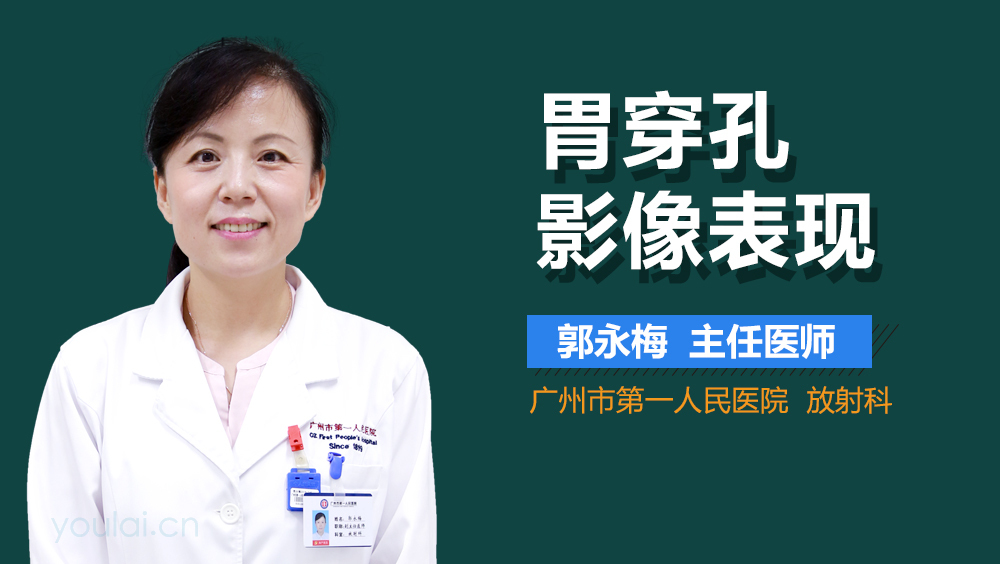 胃穿孔影像表现