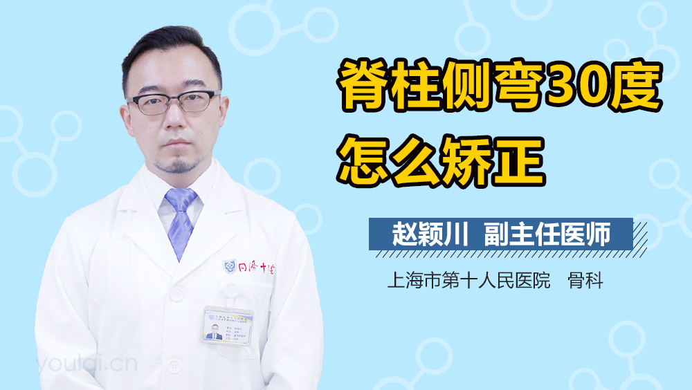 脊柱侧弯30度怎么矫正