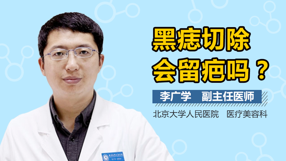 黑痣切除会留疤吗