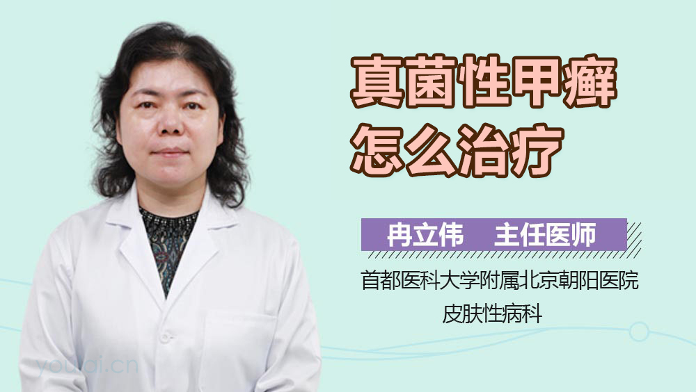 真菌性甲癣怎么治疗