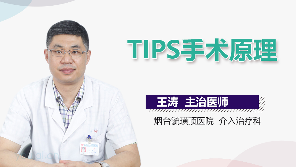 TIPS手术原理