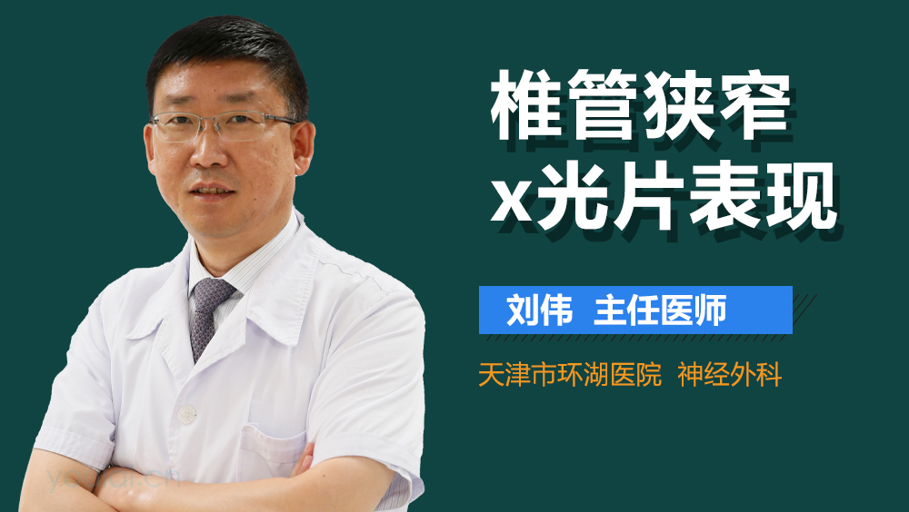 椎管狭窄x光片表现