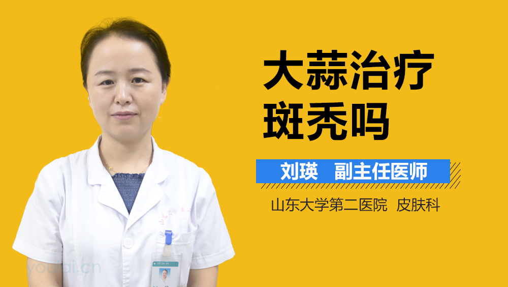 大蒜治疗斑秃吗