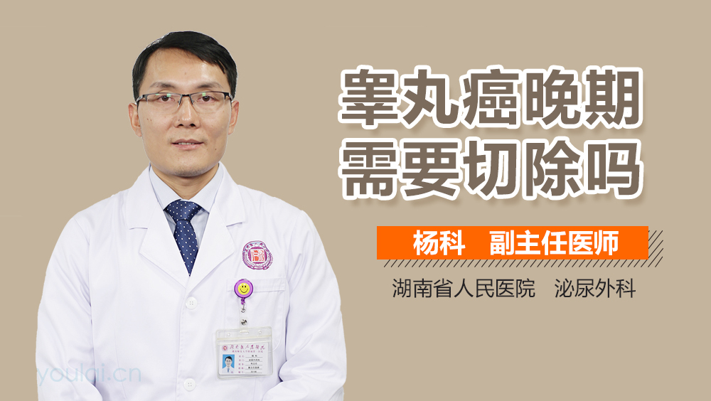 睾丸癌晚期需要切除吗