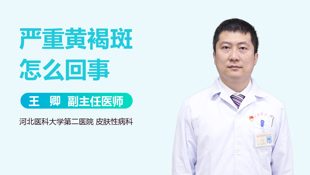 严重黄褐斑怎么回事