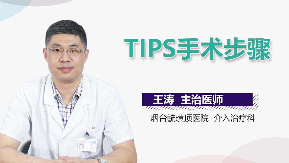TIPS手术步骤