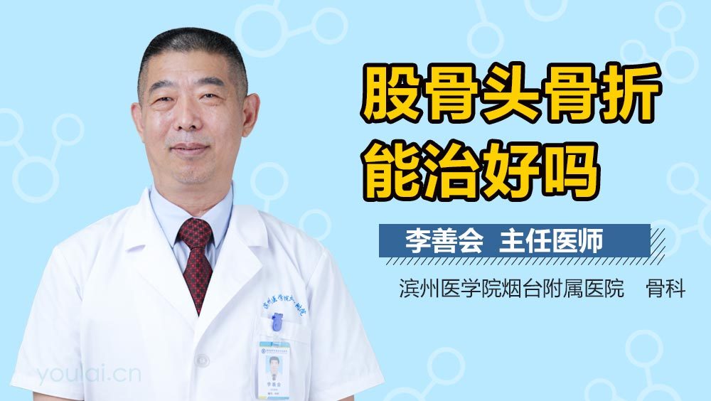 股骨头骨折能治好吗