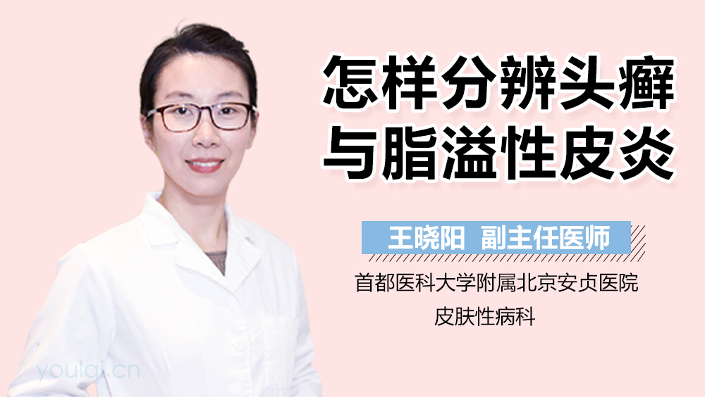 怎样分辨头癣与脂溢性皮炎