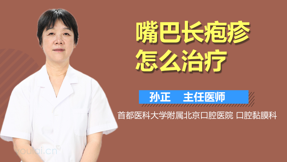 嘴巴长疱疹怎么治疗