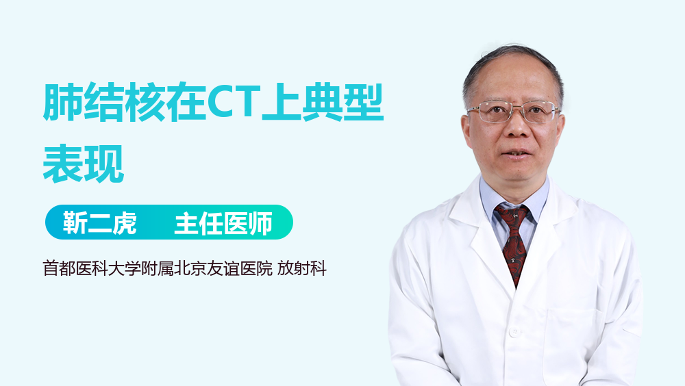 肺结核在CT上典型表现