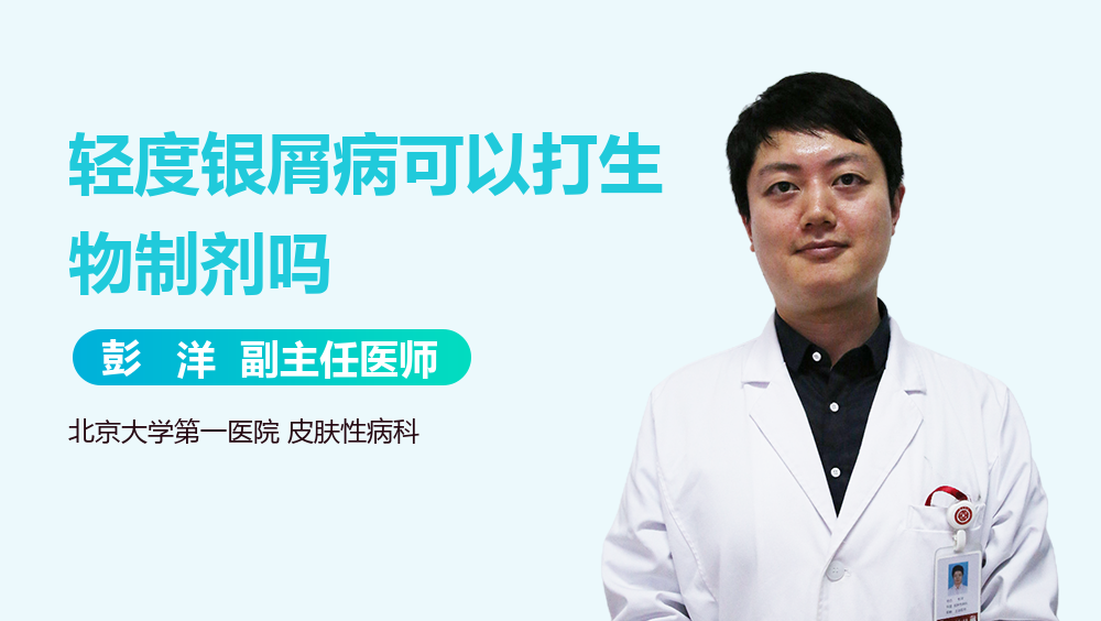 轻度银屑病可以打生物制剂吗